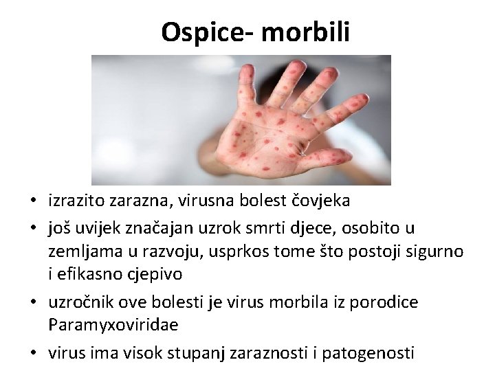 Ospice- morbili • izrazito zarazna, virusna bolest čovjeka • još uvijek značajan uzrok smrti