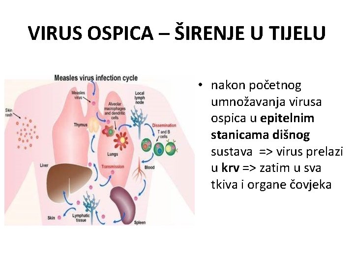 VIRUS OSPICA – ŠIRENJE U TIJELU • nakon početnog umnožavanja virusa ospica u epitelnim