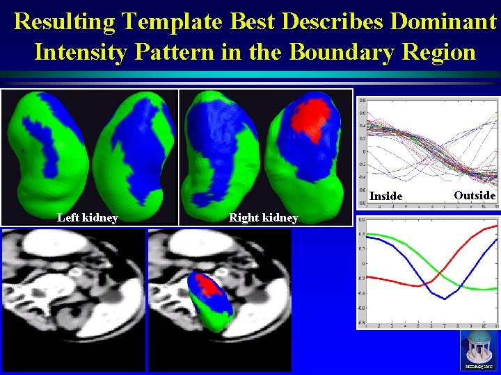 Clustering on Image Boundary Regions for Deformable Model