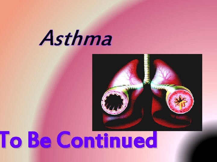 Asthma To Be Continued Asthma To Be Continued