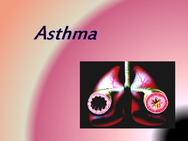 Asthma Asthma
