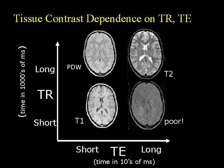 (time in 1000’s of ms) Tissue Contrast Dependence on TR, TE Long PDW T