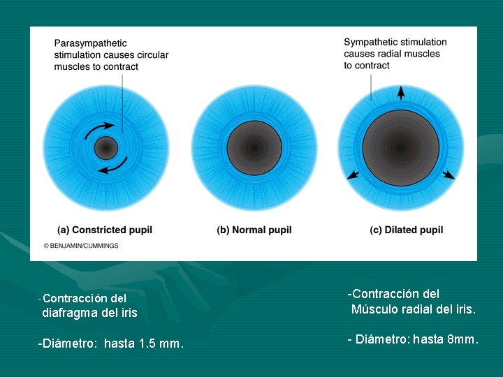 diafragma del iris -Contracción del Músculo radial del iris. -Diámetro: hasta 1. 5 mm. diafragma del iris -Contracción del Músculo radial del iris. -Diámetro: hasta 1. 5 mm.