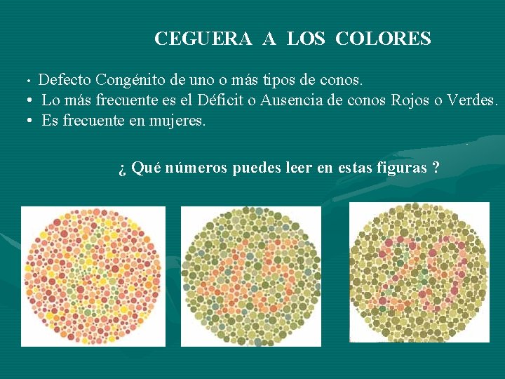 CEGUERA A LOS COLORES Defecto Congénito de uno o más tipos de conos. • CEGUERA A LOS COLORES Defecto Congénito de uno o más tipos de conos. •
