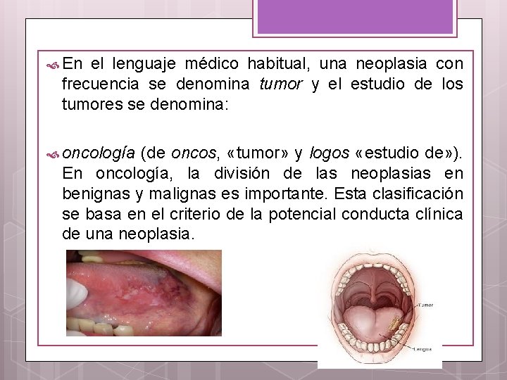  En el lenguaje médico habitual, una neoplasia con frecuencia se denomina tumor y