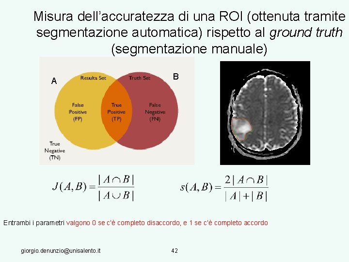 Misura dell’accuratezza di una ROI (ottenuta tramite segmentazione automatica) rispetto al ground truth (segmentazione