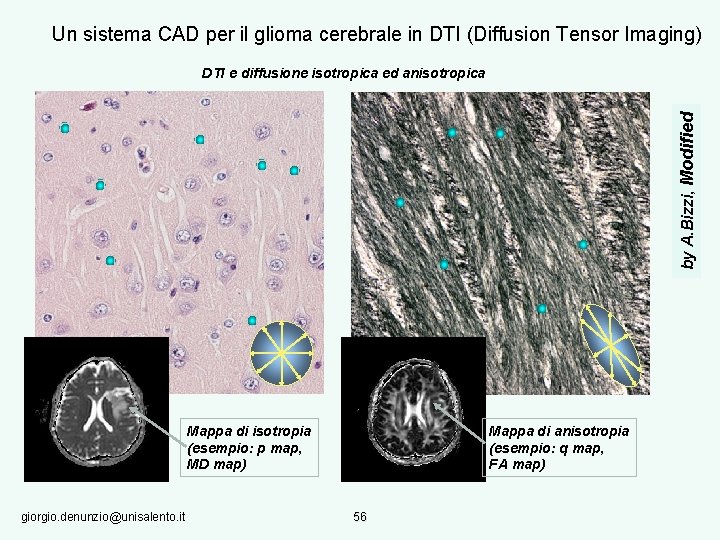 Un sistema CAD per il glioma cerebrale in DTI (Diffusion Tensor Imaging) by A.