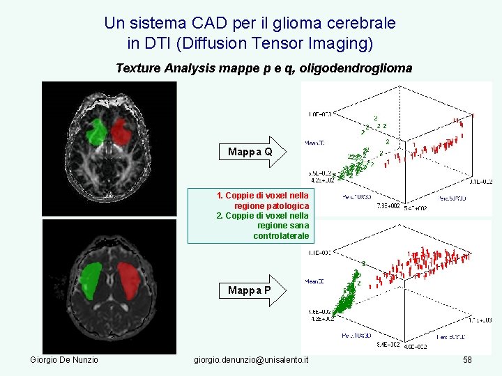 Un sistema CAD per il glioma cerebrale in DTI (Diffusion Tensor Imaging) Texture Analysis