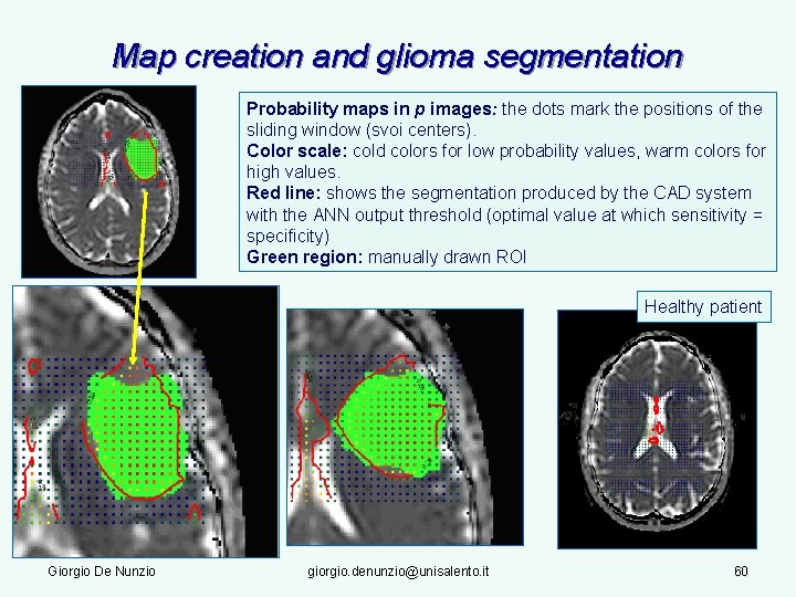 Map creation and glioma segmentation Probability maps in p images: the dots mark the