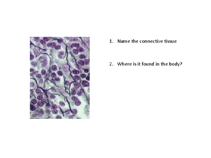 1. Name the connective tissue 2. Where is it found in the body? 