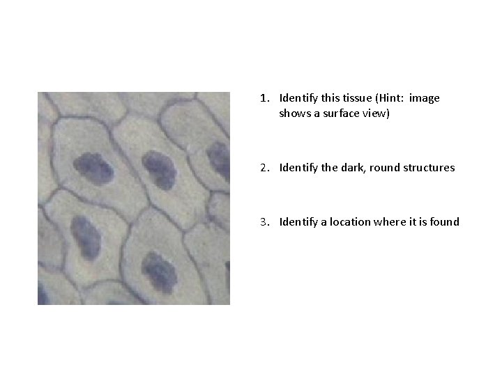 1. Identify this tissue (Hint: image shows a surface view) 2. Identify the dark,