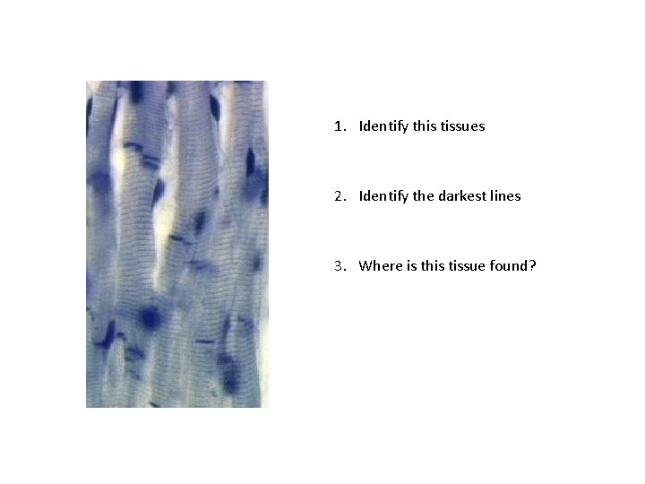 1. Identify this tissues 2. Identify the darkest lines 3. Where is this tissue