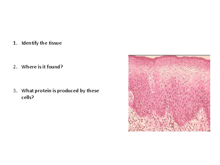 1. Identify the tissue 2. Where is it found? 3. What protein is produced