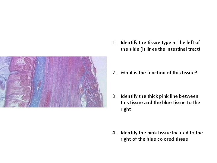 1. Identify the tissue type at the left of the slide (it lines the