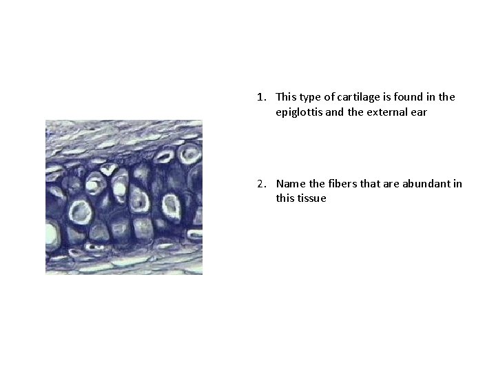 1. This type of cartilage is found in the epiglottis and the external ear