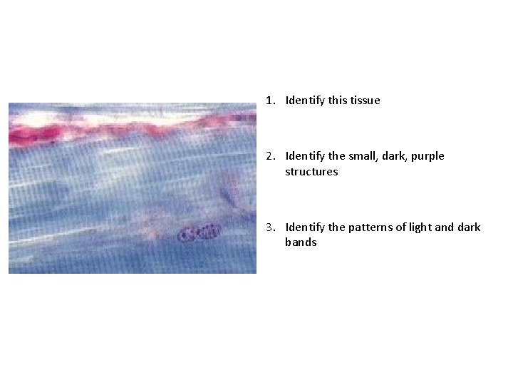 1. Identify this tissue 2. Identify the small, dark, purple structures 3. Identify the