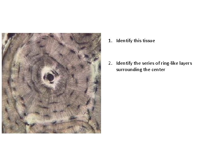 1. Identify this tissue 2. Identify the series of ring-like layers surrounding the center