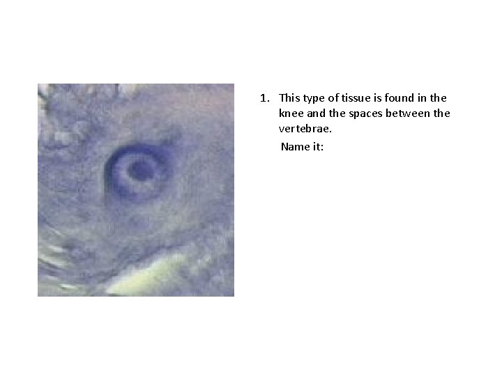 1. This type of tissue is found in the knee and the spaces between