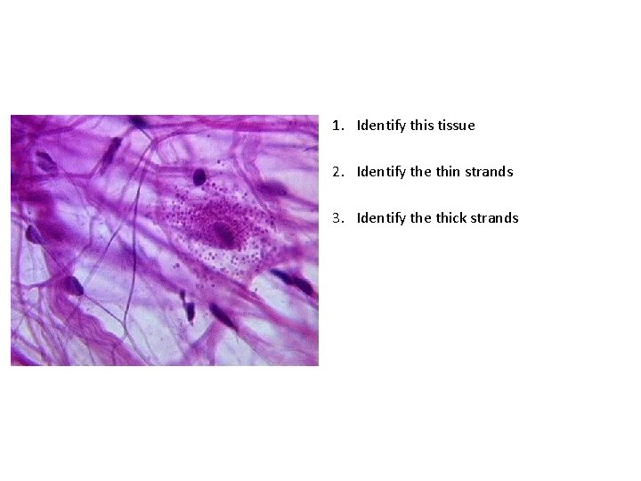 1. Identify this tissue 2. Identify the thin strands 3. Identify the thick strands