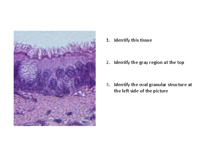 1. Identify this tissue 2. Identify the gray region at the top 3. Identify