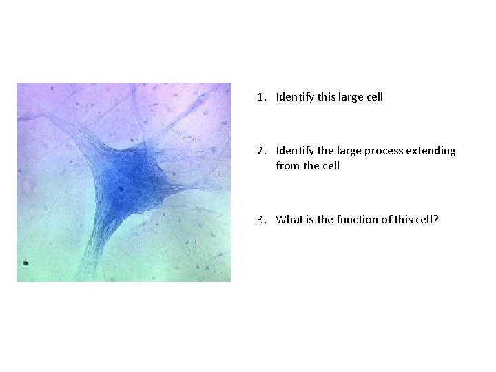 1. Identify this large cell 2. Identify the large process extending from the cell