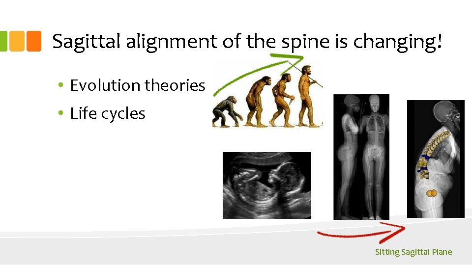 Sagittal alignment of the spine is changing! • Evolution theories • Life cycles Sitting
