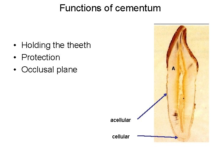Functions of cementum • Holding theeth • Protection • Occlusal plane acellular 
