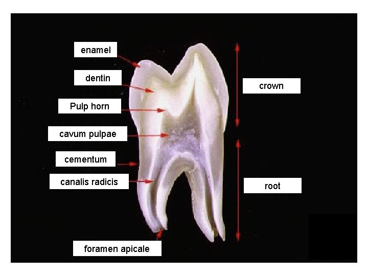 enamel dentin crown Pulp horn cavum pulpae cementum canalis radicis foramen apicale root 