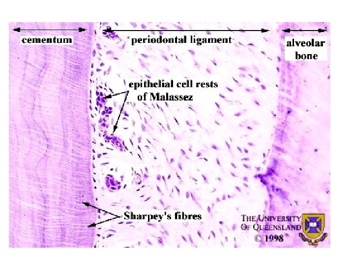 cementum lig. periodontale Malassez- féle hámszigetek Sharpey rostok Alveolus 