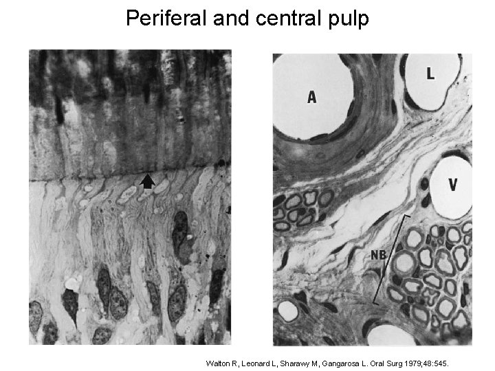 Periferal and central pulp Walton R, Leonard L, Sharawy M, Gangarosa L. Oral Surg