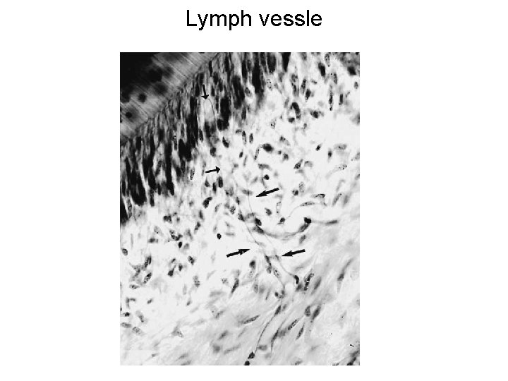 Lymph vessle 