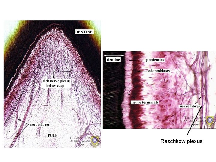 Raschkow plexus 