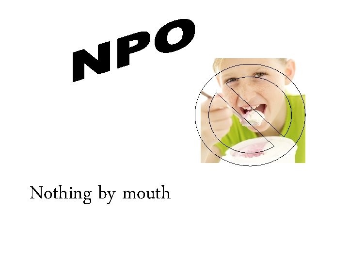 Nothing by mouth 