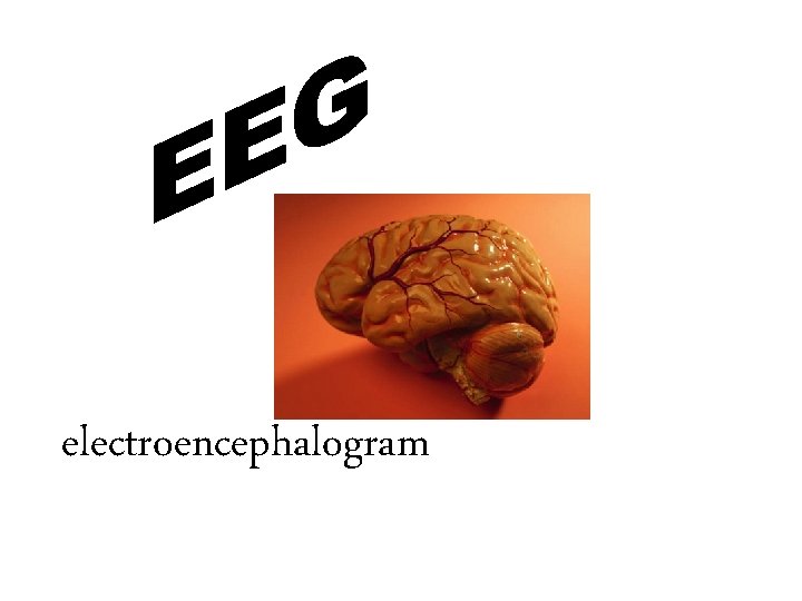 electroencephalogram 