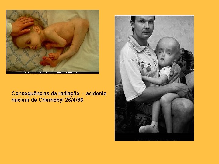 Consequências da radiação - acidente nuclear de Chernobyl 26/4/86 