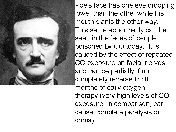 Poe's face has one eye drooping lower than the other while his mouth slants