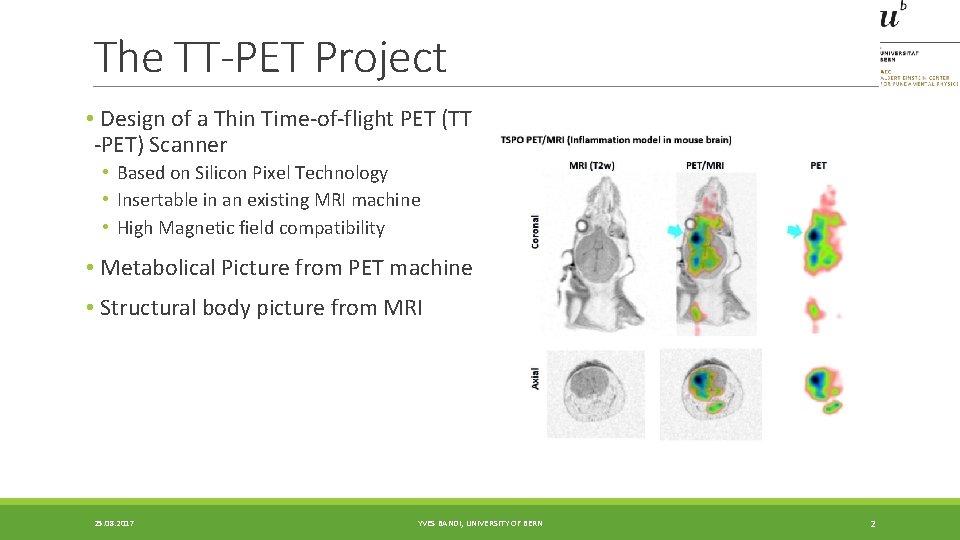 The TT-PET Project • Design of a Thin Time-of-flight PET (TT -PET) Scanner • The TT-PET Project • Design of a Thin Time-of-flight PET (TT -PET) Scanner •