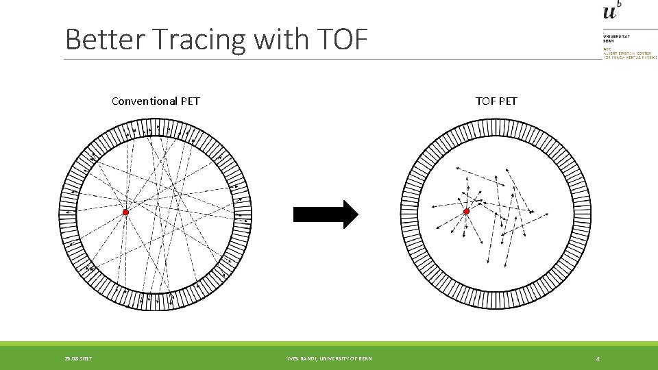 Better Tracing with TOF Conventional PET 25. 08. 2017 TOF PET YVES BANDI, UNIVERSITY Better Tracing with TOF Conventional PET 25. 08. 2017 TOF PET YVES BANDI, UNIVERSITY