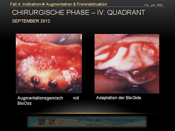 Fall 4: Indikation Augmentation & Freiendsituation Pat. geb. 1959 CHIRURGISCHE PHASE – IV. QUADRANT