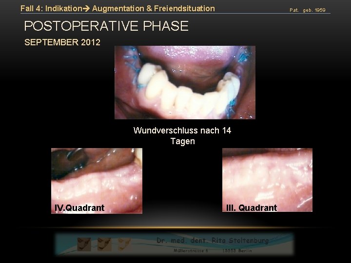 Fall 4: Indikation Augmentation & Freiendsituation Pat. geb. 1959 POSTOPERATIVE PHASE SEPTEMBER 2012 Wundverschluss