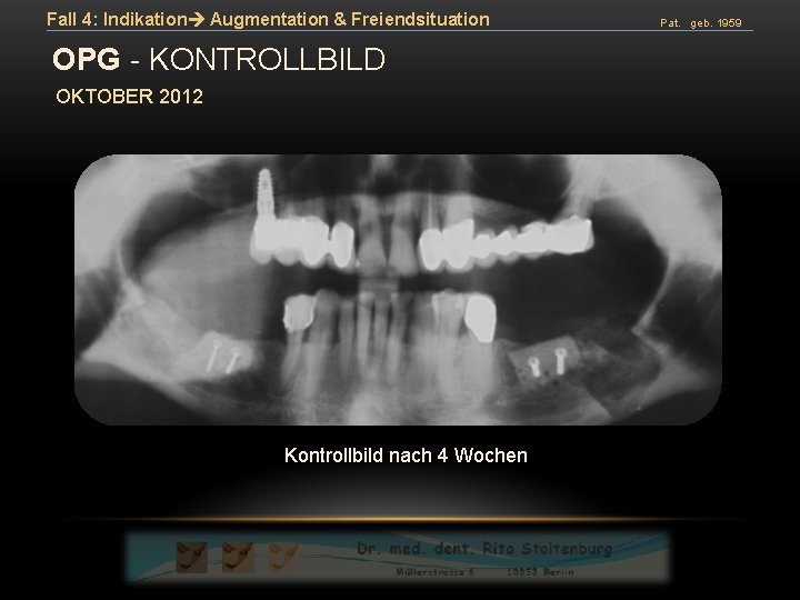 Fall 4: Indikation Augmentation & Freiendsituation OPG - KONTROLLBILD OKTOBER 2012 Kontrollbild nach 4