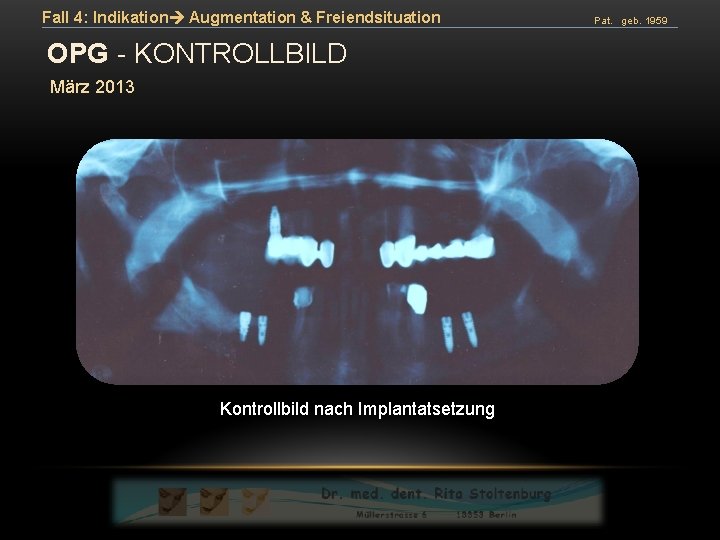Fall 4: Indikation Augmentation & Freiendsituation OPG - KONTROLLBILD März 2013 Kontrollbild nach Implantatsetzung