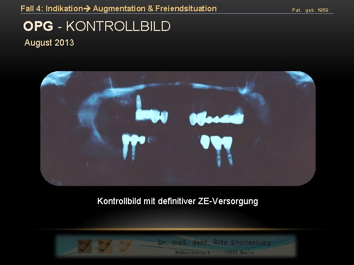 Fall 4: Indikation Augmentation & Freiendsituation OPG - KONTROLLBILD August 2013 Kontrollbild mit definitiver