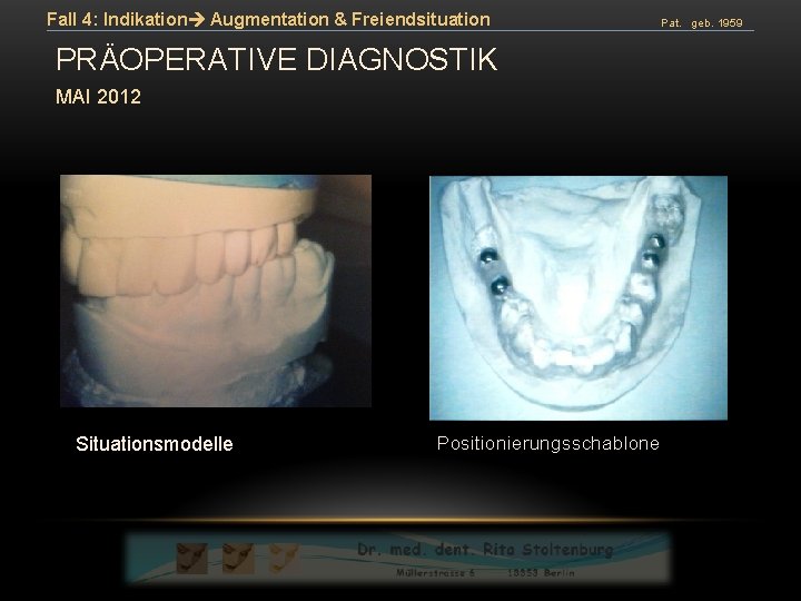 Fall 4: Indikation Augmentation & Freiendsituation PRÄOPERATIVE DIAGNOSTIK MAI 2012 Situationsmodelle Positionierungsschablone Pat. geb.