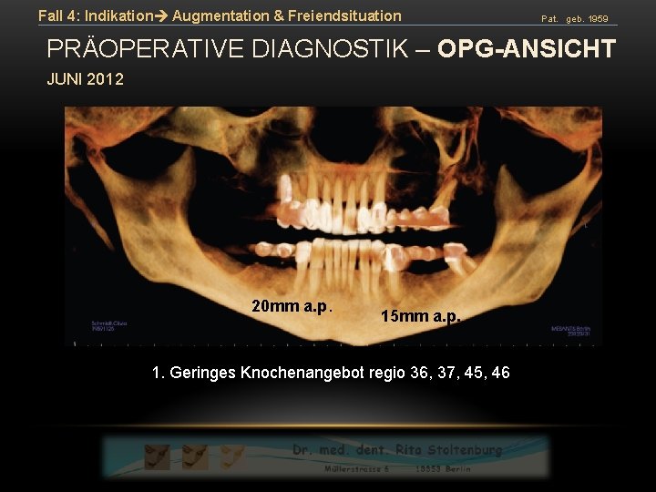 Fall 4: Indikation Augmentation & Freiendsituation Pat. geb. 1959 PRÄOPERATIVE DIAGNOSTIK – OPG-ANSICHT JUNI