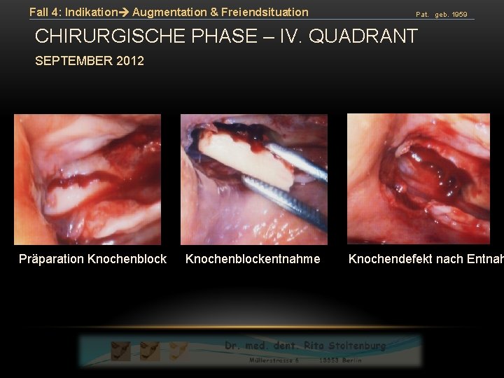 Fall 4: Indikation Augmentation & Freiendsituation Pat. geb. 1959 CHIRURGISCHE PHASE – IV. QUADRANT