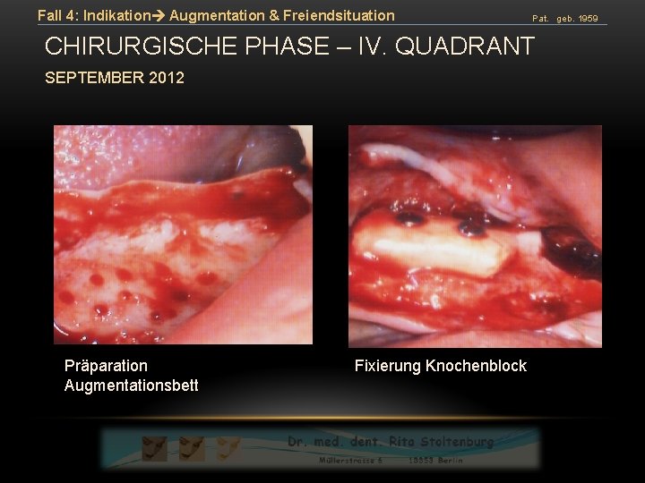 Fall 4: Indikation Augmentation & Freiendsituation Pat. geb. 1959 CHIRURGISCHE PHASE – IV. QUADRANT