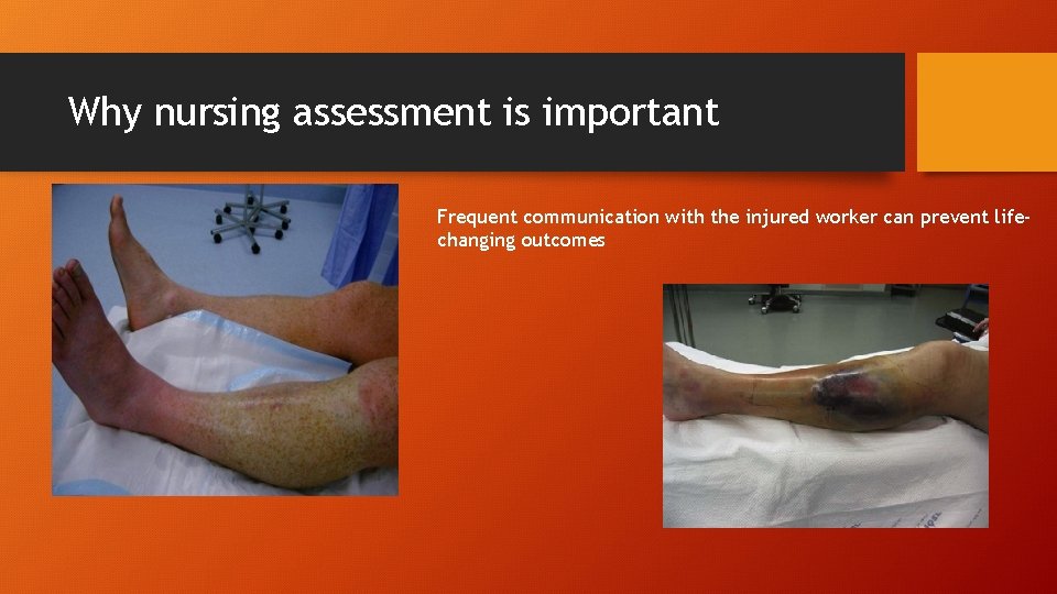 Why nursing assessment is important Frequent communication with the injured worker can prevent lifechanging