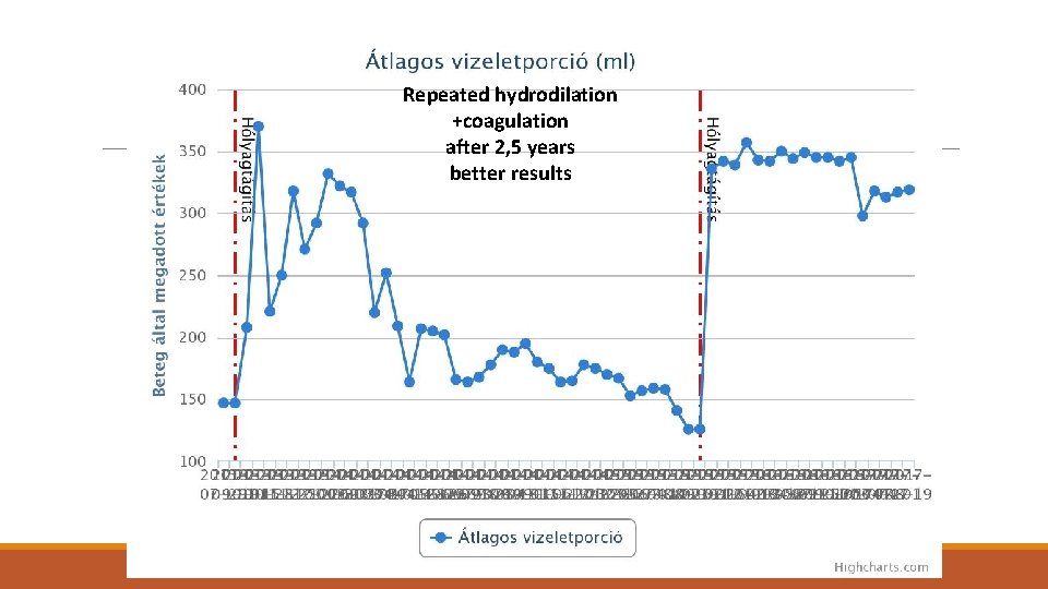 Repeated hydrodilation +coagulation after 2, 5 years better results 