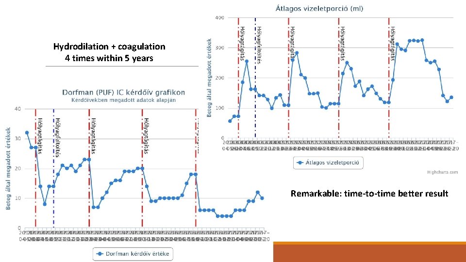 Hydrodilation + coagulation 4 times within 5 years Remarkable: time-to-time better result 